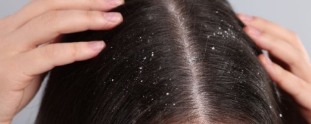TriKh Hairlife | trattamento intensivo antiforfora